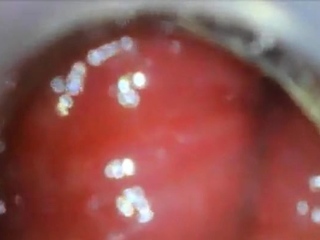 Anal Endoscope Ass Play From Inside