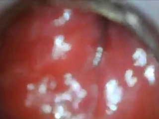 Anal Endoscope Ass Play From Inside